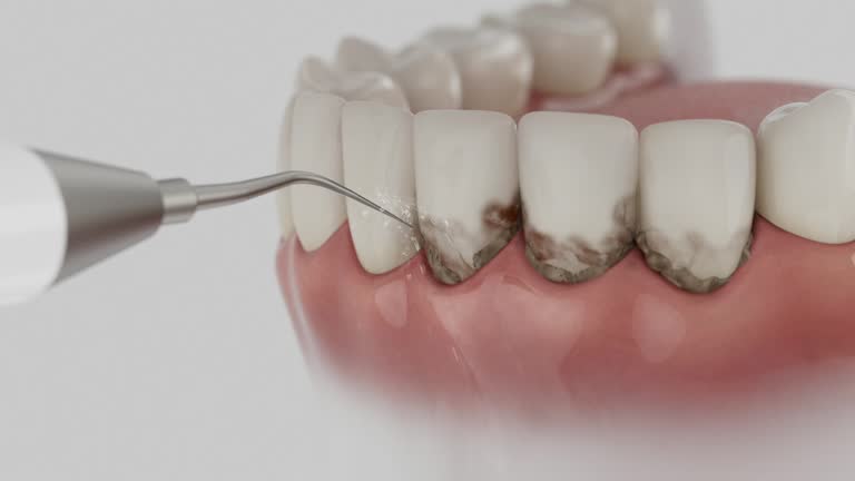 Trusted Teeth Cleaning And Checkup service in Apollo, PA - Dentist Open Now